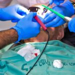 Blanqueamiento dental