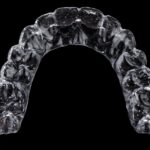 Brackets o alineadores invisibles